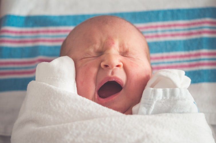Mama Harus Tahu 14 Fakta Penyakit Kuning Bayi Baru Lahir
