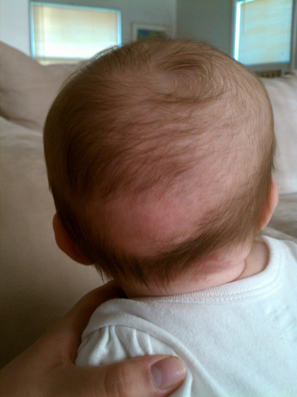 3. Kondisi kulit kepala bayi
