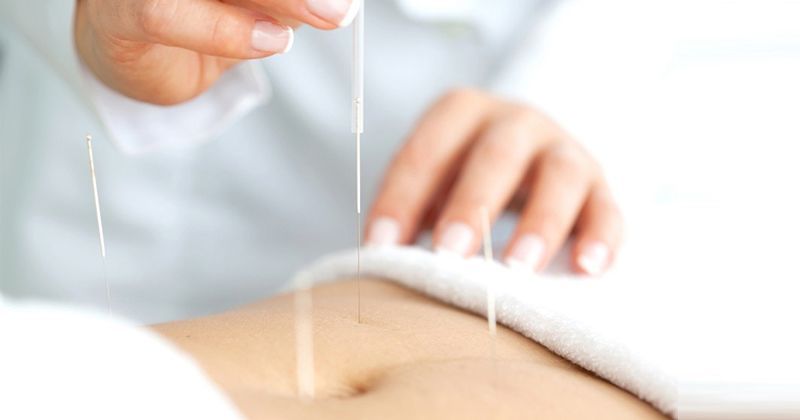 3. Terapi Akupunktur
