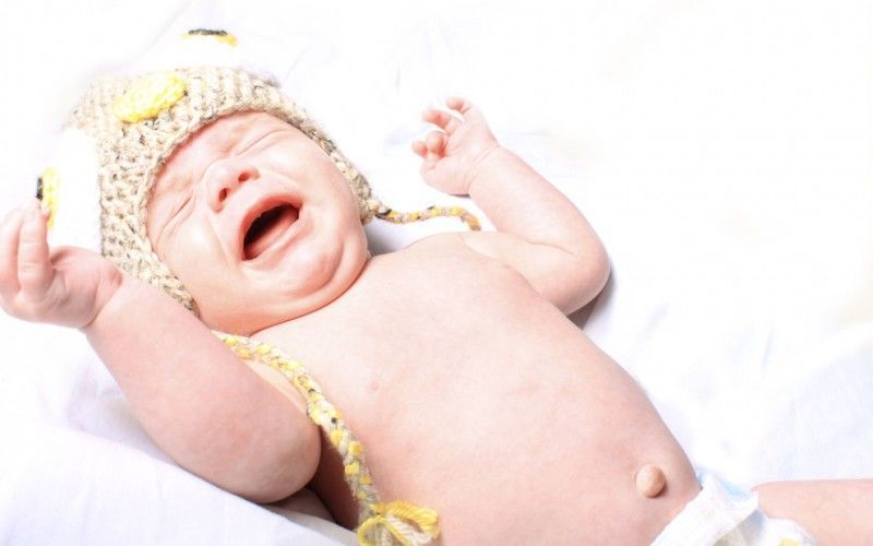 Hernia Bayi Kenali Jenis Gejala Mulai Sekarang