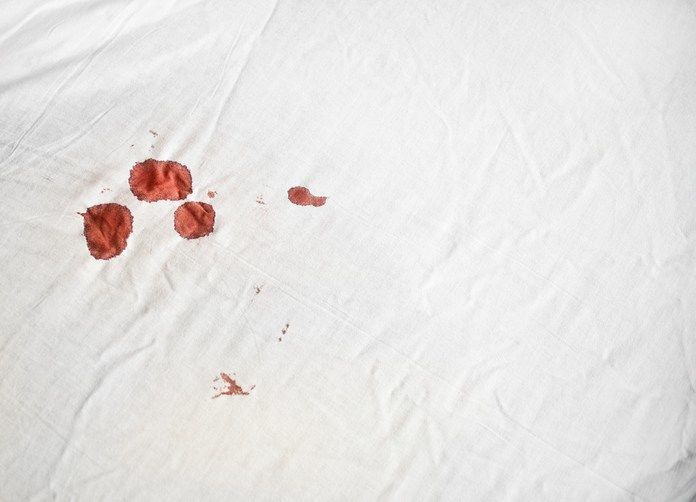 Cara Membedakan Darah Menstruasi dan Flek Tanda Kehamilan