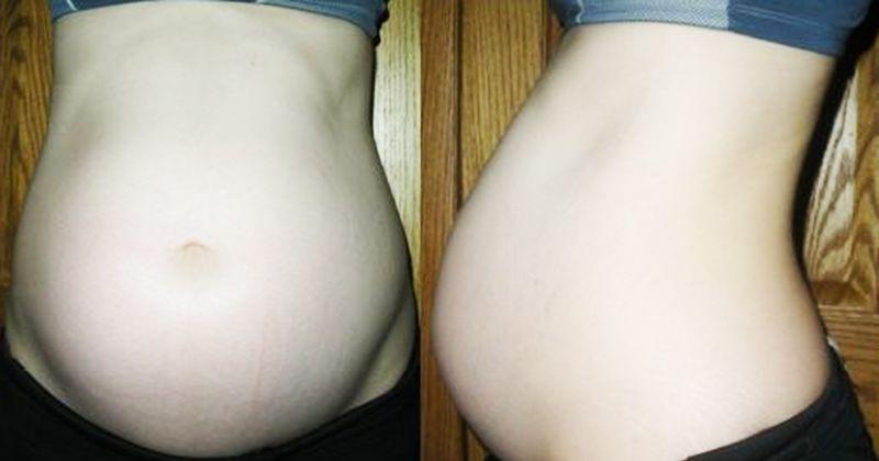 10. Mencegah stretch mark saat hamil