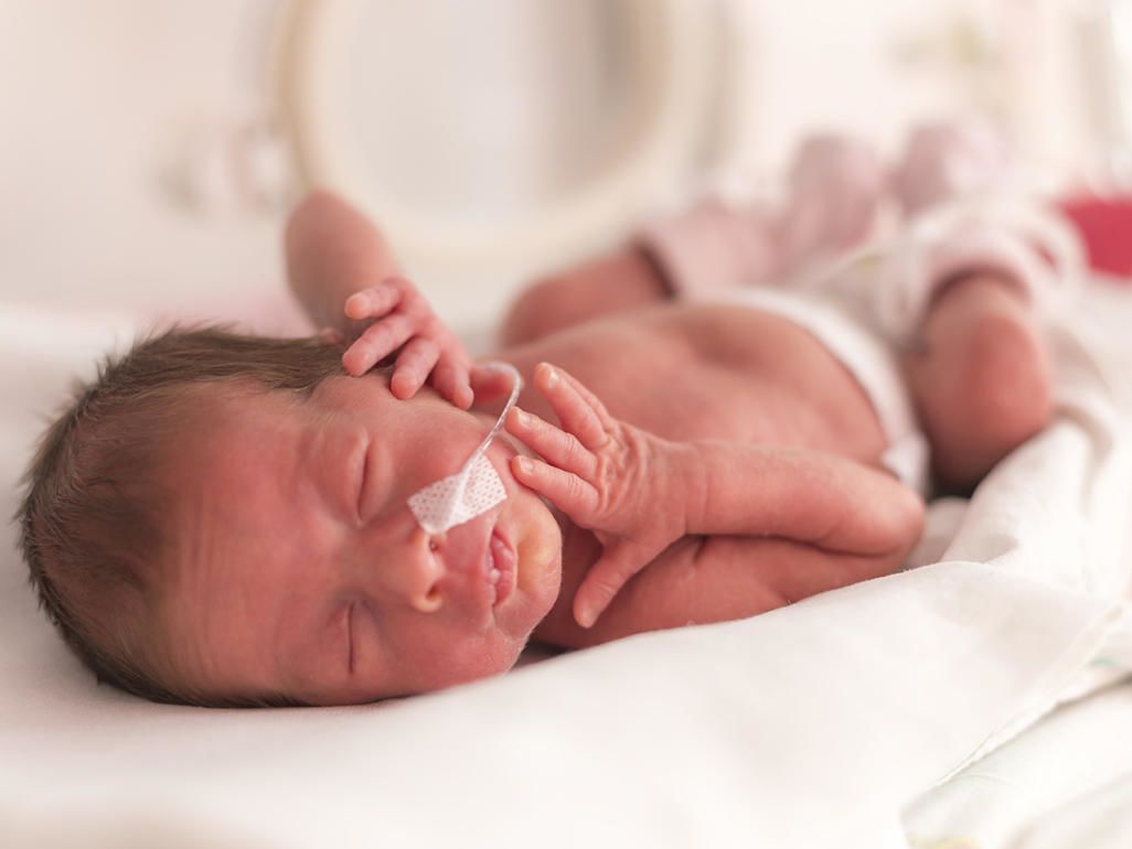 Cara Merawat Bayi Prematur Di Rumah Yang Aman Popmama Com