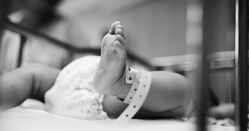 3. Bayi terlahir hydrocephalus