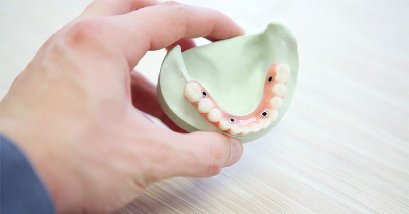 2. Menjaga kondisi gigi mulut
