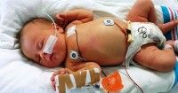 Bayi 4 Bulan Parepare Terkena Virus Corona Setelah Ayah Makan-makan