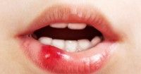 3. Mengalami luka atau trauma bagian dalam sekitar mulut
