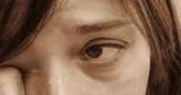 5. Visual hipertensi