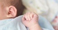 3. Kondisi bayi cyclopia setelah lahir