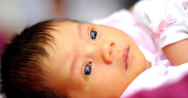  Mata  Bayi  Kuning Umur 1  Bulan Berbagai Mata 