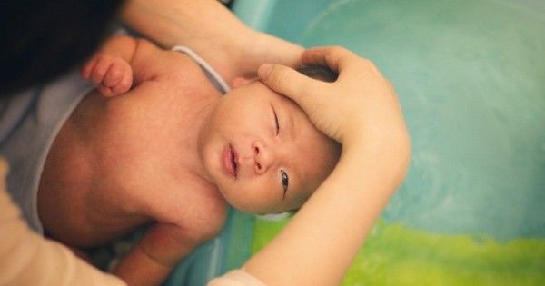 Cara Merawat Kulit Bayi Yang Mengelupas Popmama 