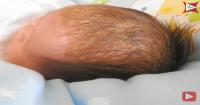 4. Atasi cradle cap atau kerak kulit kepala