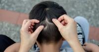 2. Peterseli jadi solusi alami infeksi kutu rambut
