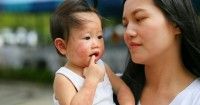 Bintik Merah Kulit Bayi Setelah Demam, Bahayakah Ini 3 Penyebabnya