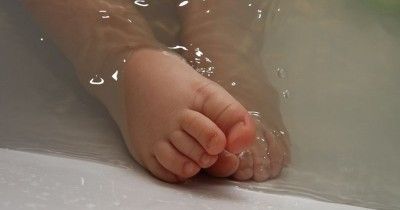 Kaki Bayi Bengkok Gejala, Penyebab, Cara Mengatasinya