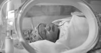 4. Vernix terdiri dari berbagai warna
