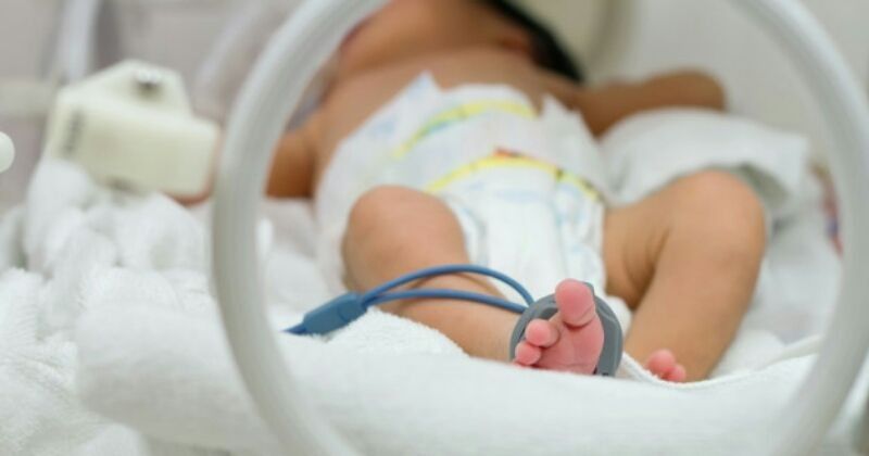 Bayi penderita erythroblastosis lahir dari pasangan