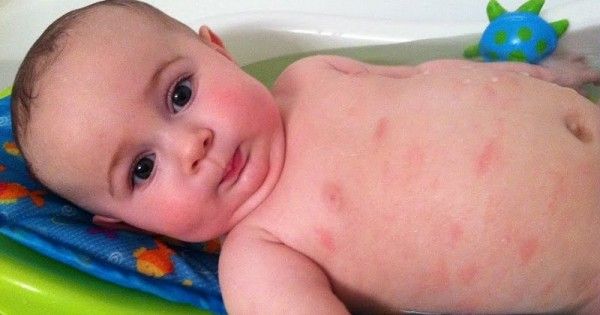 4 Penyebab Kulit Bayi Kering Yang Harus Mama Tahu Popmama Com