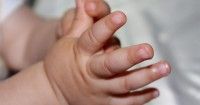 Jenis Kelainan Bentuk Jari Tangan Kaki Bayi