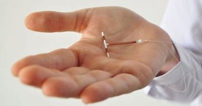 7 Efek Samping KB IUD Pasca Persalinan Selain Timbulkan Rasa Nyeri