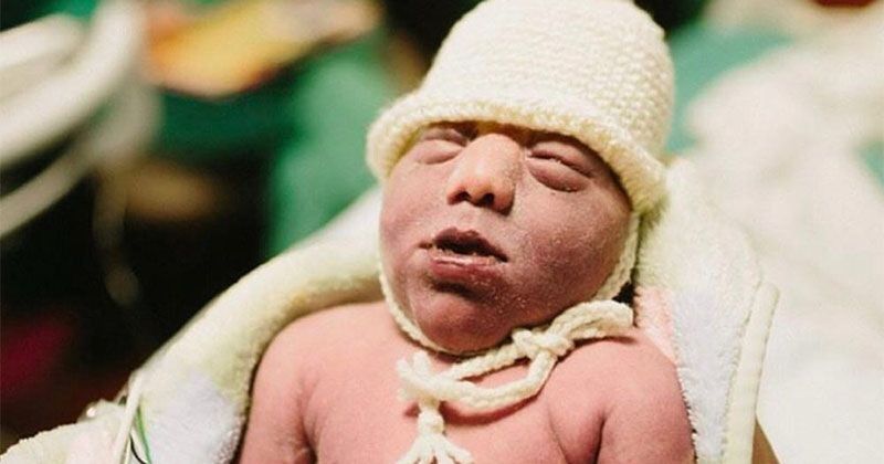 Serba serbi Bayi Tanpa Tempurung Kepala  Popmama com