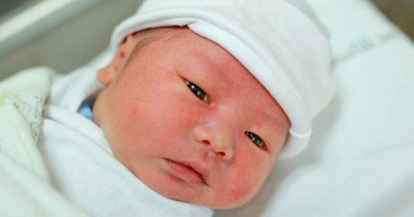 Kulit Bayi Baru Lahir Mengelupas Wajarkah Popmama Com