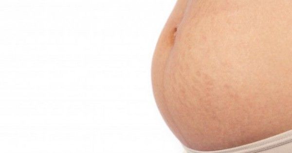 5 Perubahan Normal Pada Tubuh Ibu Hamil Dan Tips Mengatasinya Popmama Com