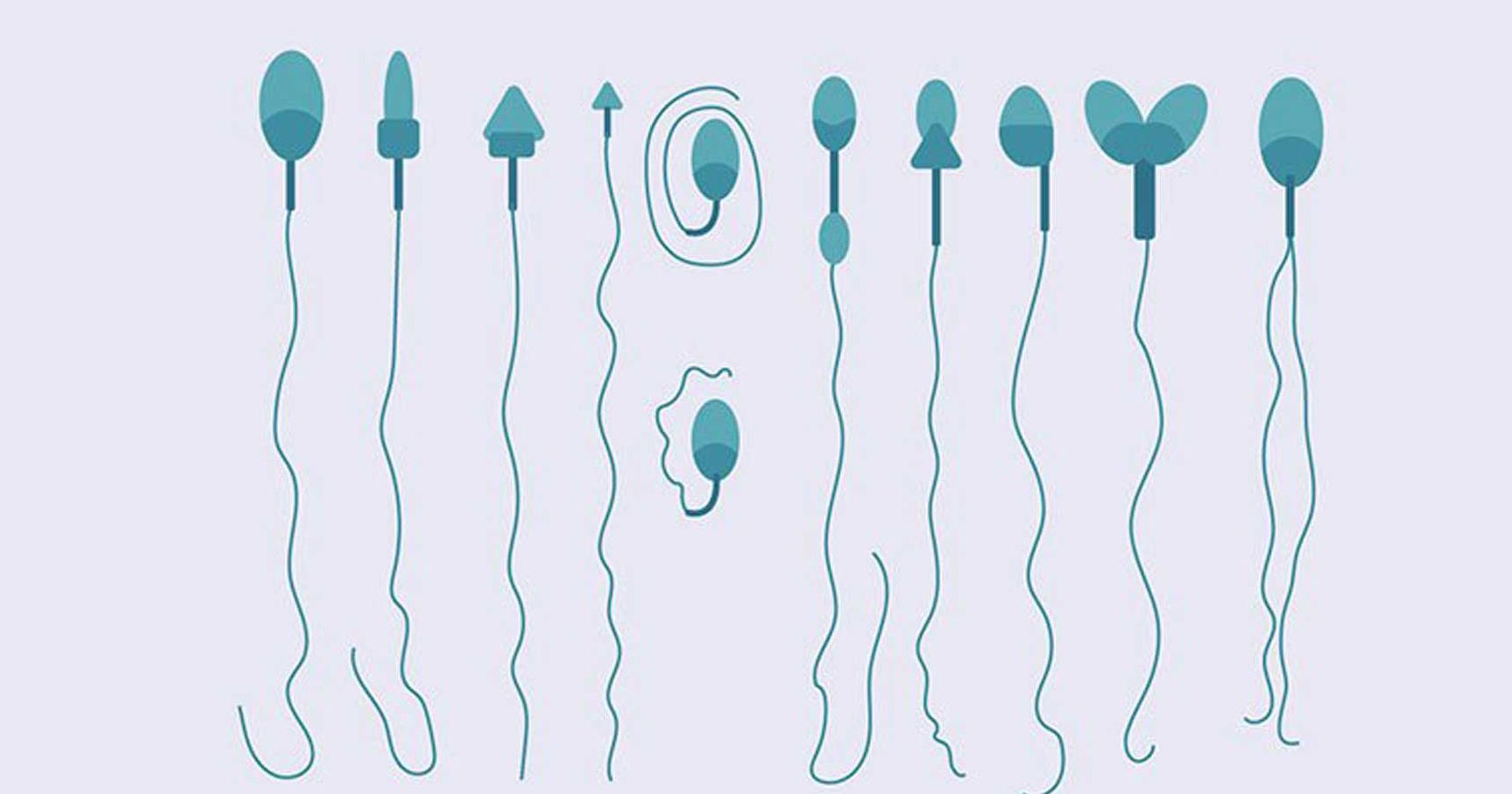 2. Jenis-jenis kelainan sperma umum dialami oleh laki-laki