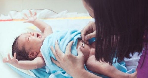 Penyebab Perdarahan Pada Pusar Bayi Baru Lahir Popmama 