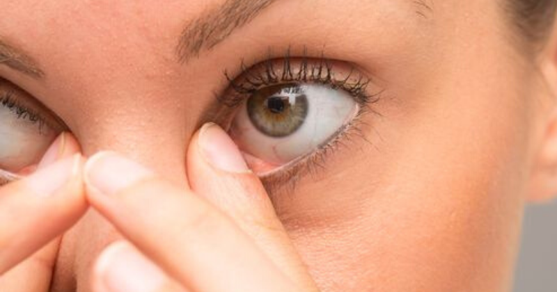 Inilah Penyebab Mata Mama Bintitan, Bagaimana Mengatasinya? | Popmama.com