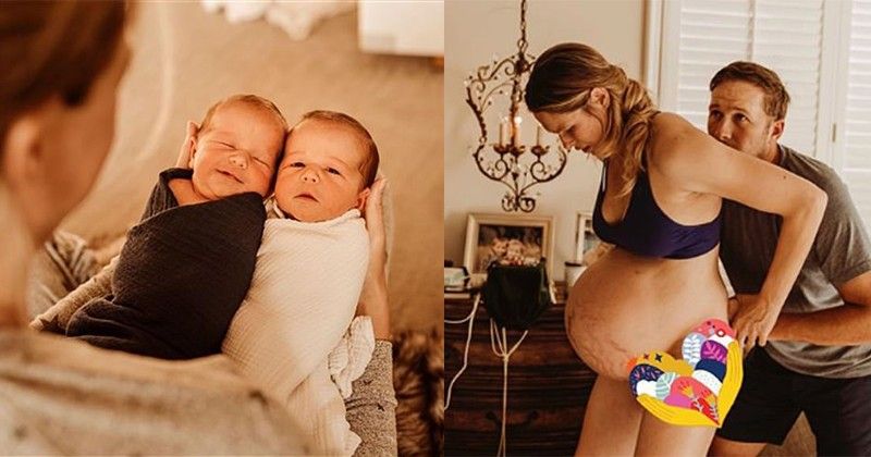 Kisah Istri Bode Miller saat Melahirkan Anak Kembar di Rumah | Popmama.com