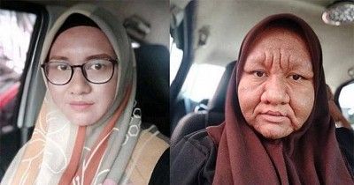 Benarkah Penggunaan Krim Pemutih Untuk Ibu Hamil Berbahaya