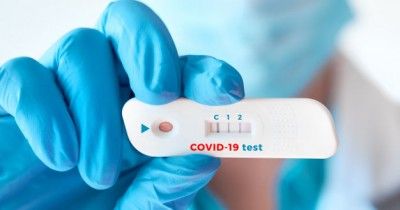 7 Rekomendasi Tempat Tes Swab Antigen & PCR di Jogja yang Terpercaya