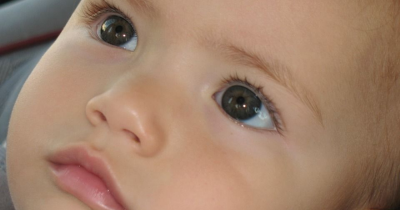 7 Jenis Penyakit Mata Bayi Perlu Orangtua Waspadai