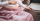 Bagaimana Kehamilan Memengaruhi Kondisi Lupus