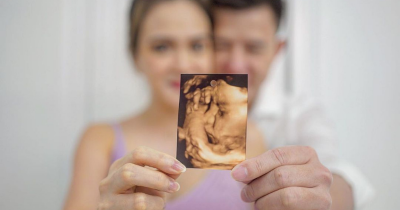 Perbandingan Wajah Bayi Selebritis Sekarang dan Foto USG di Kandungan 
