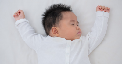 Ketombe pada Bayi: Gejala, Penyebab, dan Cara Mengatasinya