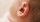 4. Ada infeksi terjadi telinga bayi
