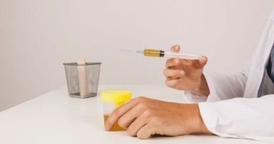 Kegunaan Tes Urine saat Pemeriksaan Kehamilan