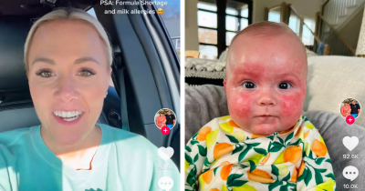 Cerita Mama Alami Krisis Susu Formula AS, Sebabkan Bayi Alergi