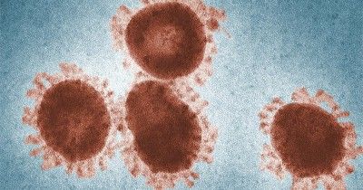 Apa Itu Virus Hendra? Ketahui Gejala dan Penularannya