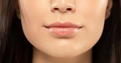 Cara Mengatasi Kulit Gelap Sekitar Bibir Mengganggu Penampilan