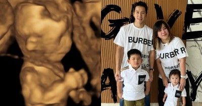 Istri Marcus Gideon Hamil Anak Ketiga, Pamer Test Pack Hasil USG