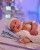 4. Saat baru lahir, Baby Amela harus dibawa ke NICU