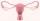 2. Abnormalitas uterus atau serviks