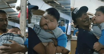 9 Fakta Kasus Viral Bayi Obesitas di Bekasi, Menkes Ikut Turun Tangan