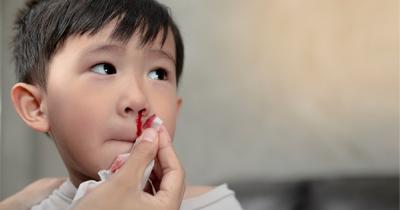 Jangan Panik, Ini Cara Mengatasi Anak Mimisan dengan Cepat