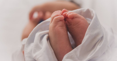 Bayi Kupang Memiliki Janin Dalam Perutnya, Apa Penyebabnya