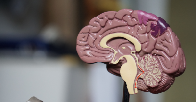 Tahukah Kamu Perbedaan Otak Besar dan Otak Kecil?